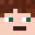 Desler's head