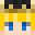 Rs_Liam's head